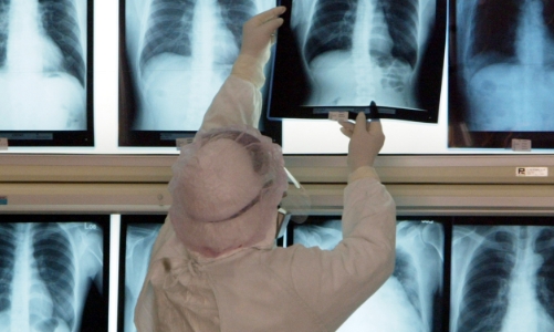 Ứng dụng AI giúp dự báo chính xác bệnh nhân Covid-19 sẽ diễn biến nặng