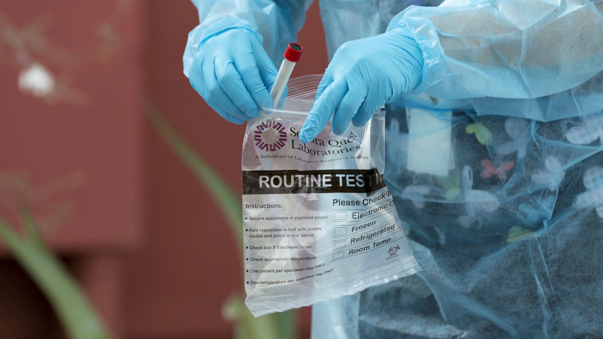 Biến thể Delta nằm trong danh s&aacute;ch &ldquo;biến thể đ&aacute;ng lo ngại&rdquo; của CDC Mỹ - Ảnh: Nytimes