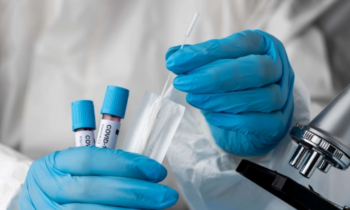 TP.HCM: Test gần 1 triệu mẫu, khoảng 3,5% mẫu dương tính