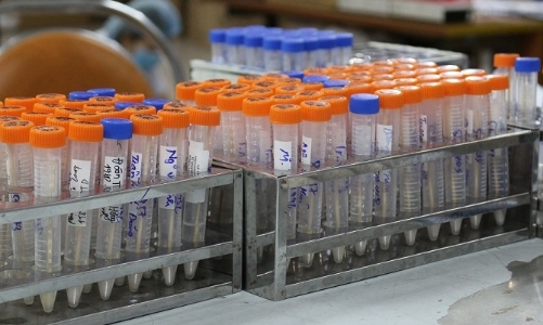 Hà Nội đề nghị người ho, sốt liên hệ với cơ sở y tế để xét nghiệm SARS-CoV-2 