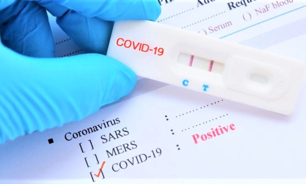 Muốn đưa test nhanh Covid-19 vào diện bình ổn giá phải được Quốc hội thông qua