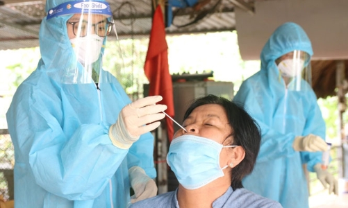 Không thực hiện xét nghiệm Covid-19 đối với người dân cần đi lại 