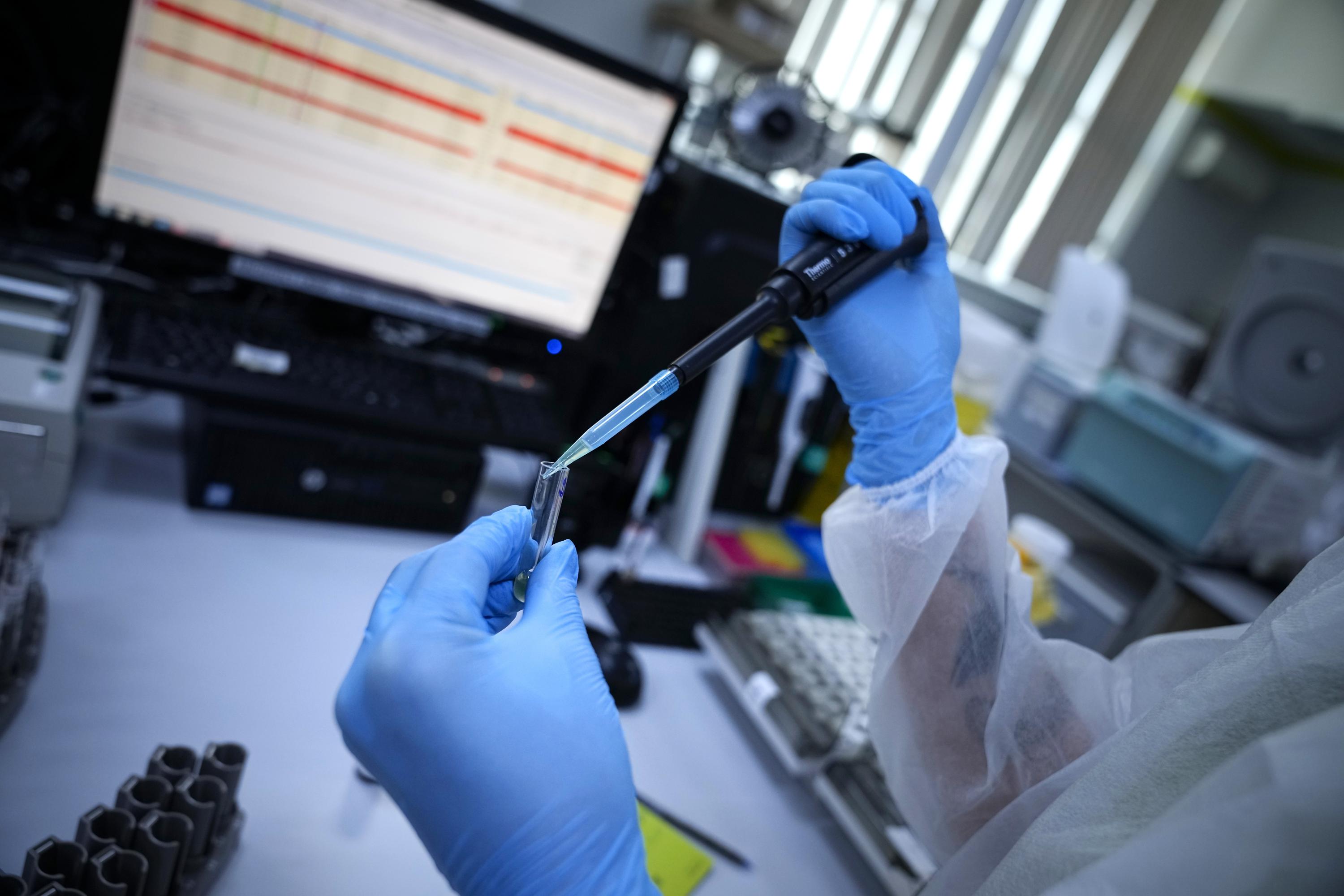 Ở Nga, c&aacute;c x&eacute;t nghiệm kh&aacute;ng thể phổ biến rộng r&atilde;i v&agrave; được c&aacute;c ph&ograve;ng kh&aacute;m tư nh&acirc;n quảng b&aacute; t&iacute;ch cực tr&ecirc;n to&agrave;n quốc.