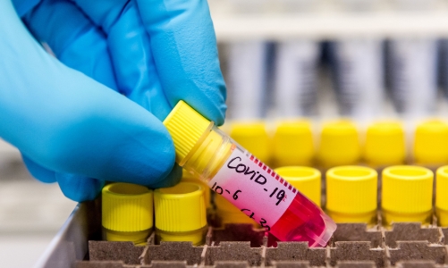 Phát hiện mới: Vaccine Pfizer giảm hiệu quả miễn dịch trước biến thể Omicron