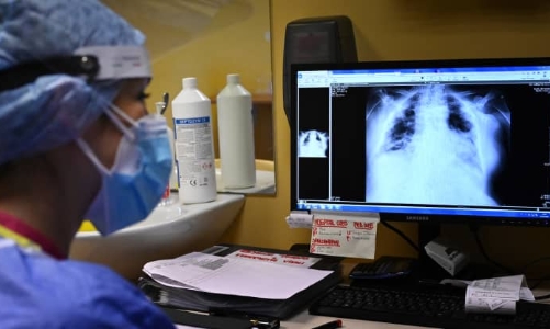 Nghiên cứu: Tốc độ nhân đôi của Omicron nhanh gấp 70 lần Delta