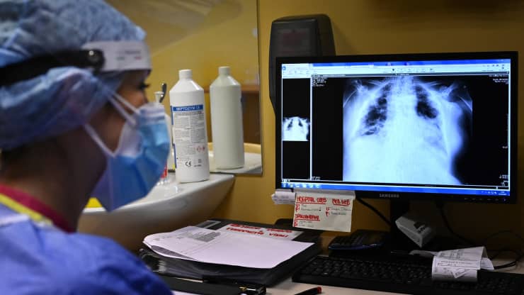 Nghiên cứu: Tốc độ nhân đôi của Omicron nhanh gấp 70 lần Delta