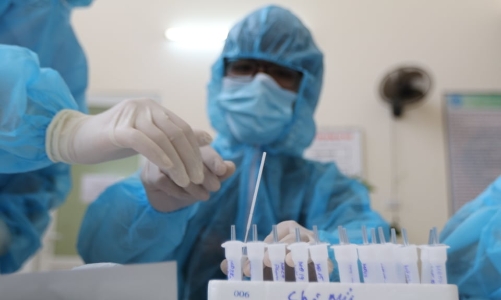 Ngày 5/2: Thêm 12.170 ca Covid-19, Hà Nội vẫn nhiều nhất cả nước 