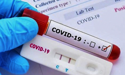 Cơ sở kinh doanh phải niêm yết giá bán test xét nghiệm Covid-19