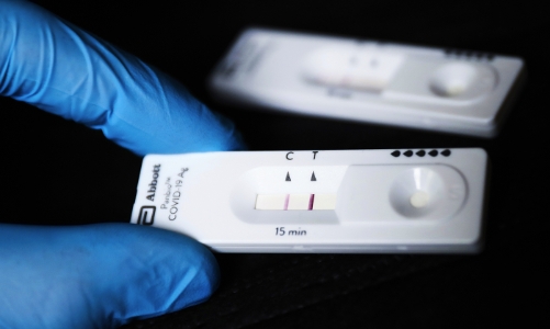 Omicron và hiện tượng “xét nghiệm dương tính hơn một lần”