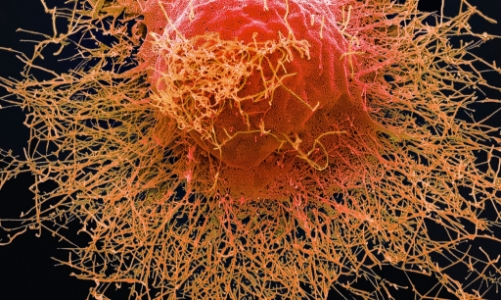 Virus “siêu cảm cúm” tại Australia làm dấy lên những lo ngại mới