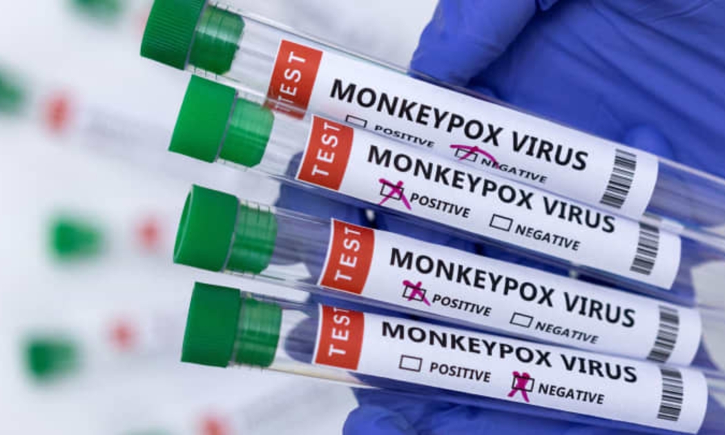 Các ống xét nghiệm có nhãn âm tính và dương tính với virus đậu mùa khỉ - Ảnh: Reuters