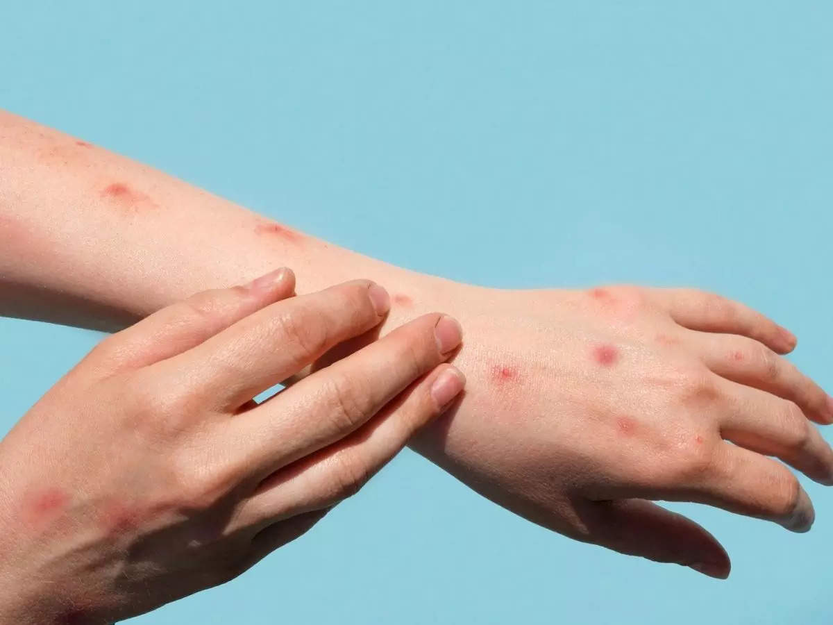 Có vẻ như đã có một số sự kiện gây phát tán virus rộng và tạo điều kiện cho bệnh lây lan nhanh sang nhiều quốc gia.