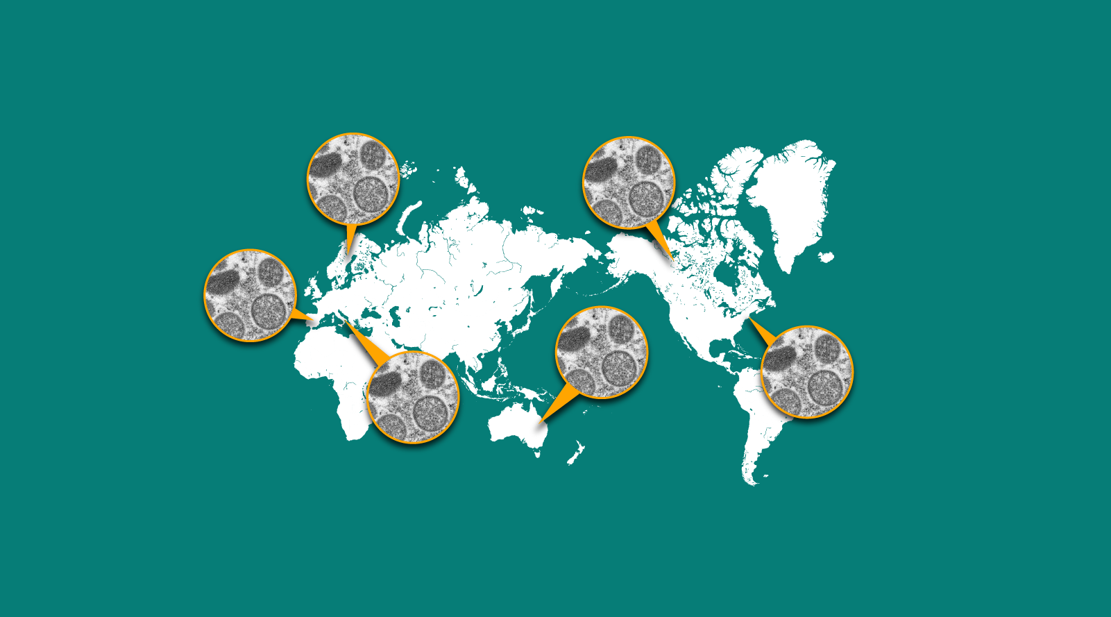 Số ca nhiễm tại Mỹ đ&atilde; bắt đầu chững lại, trong khi ch&acirc;u &Acirc;u đang l&agrave; trung t&acirc;m của sự l&acirc;y lan bệnh đậu m&ugrave;a khỉ.