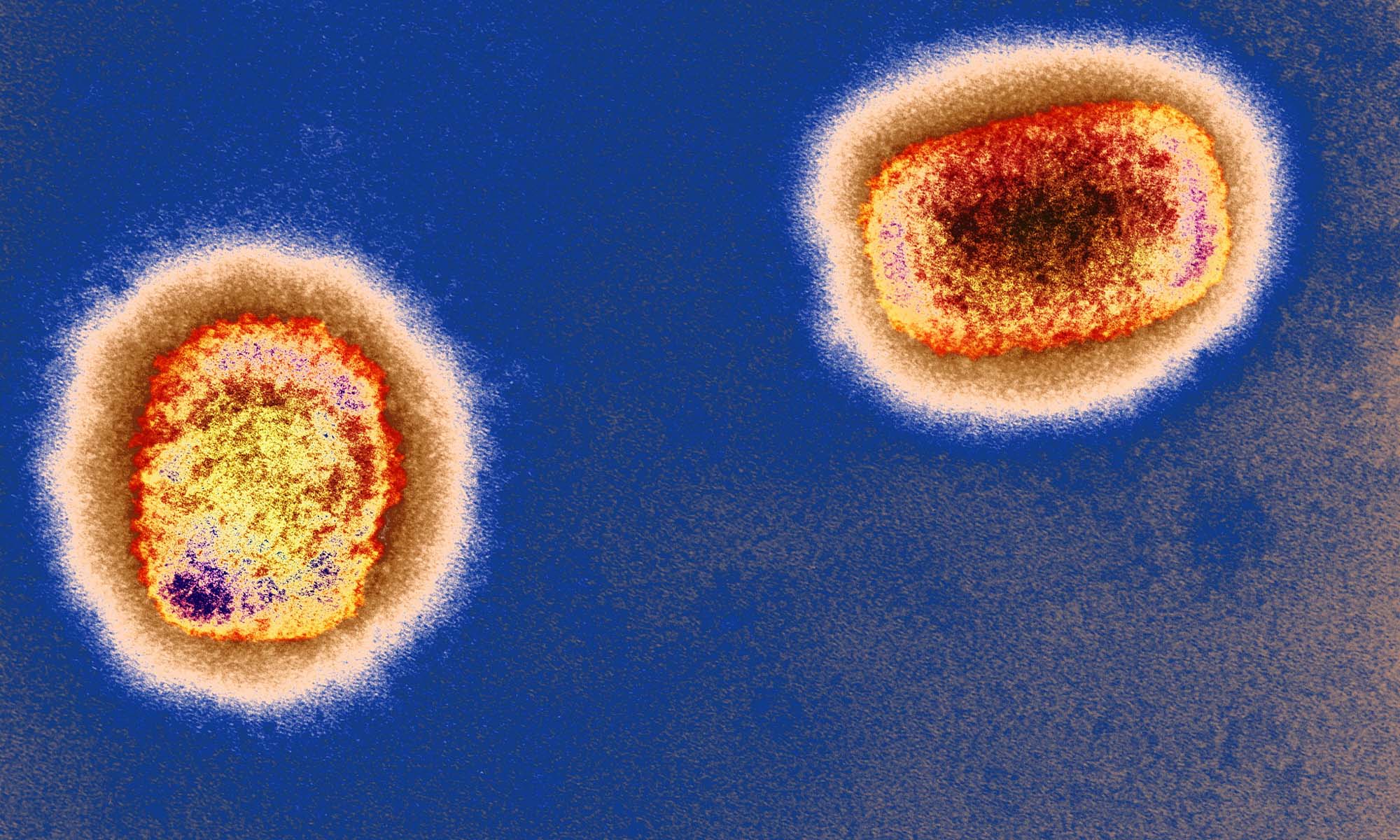 Nhóm chuyên gia tại Đức phát hiện virus đậu mùa khỉ tồn tại nhiều nhất trên bề mặt phòng tắm, áo sơ mi, vỏ gối...