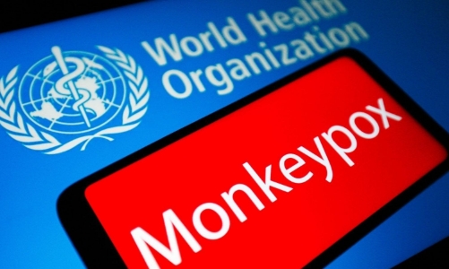 WHO: Đậu mùa khỉ là tình trạng khẩn cấp toàn cầu!
