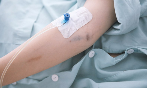 Ca mắc sốt xuất huyết tại Hà Nội tăng 4,5 lần