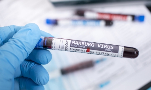 Virus Marburg: Cảnh báo nguy cơ dịch chồng dịch