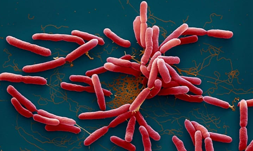 Thanh Hóa ghi nhận một trường hợp mắc bệnh Whitmore 