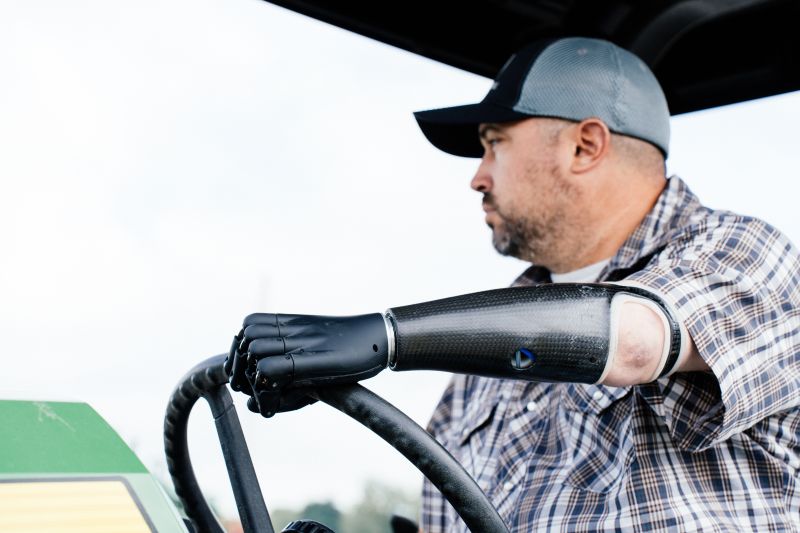 Jeremy Schroeder với c&aacute;nh tay thần Zeus.