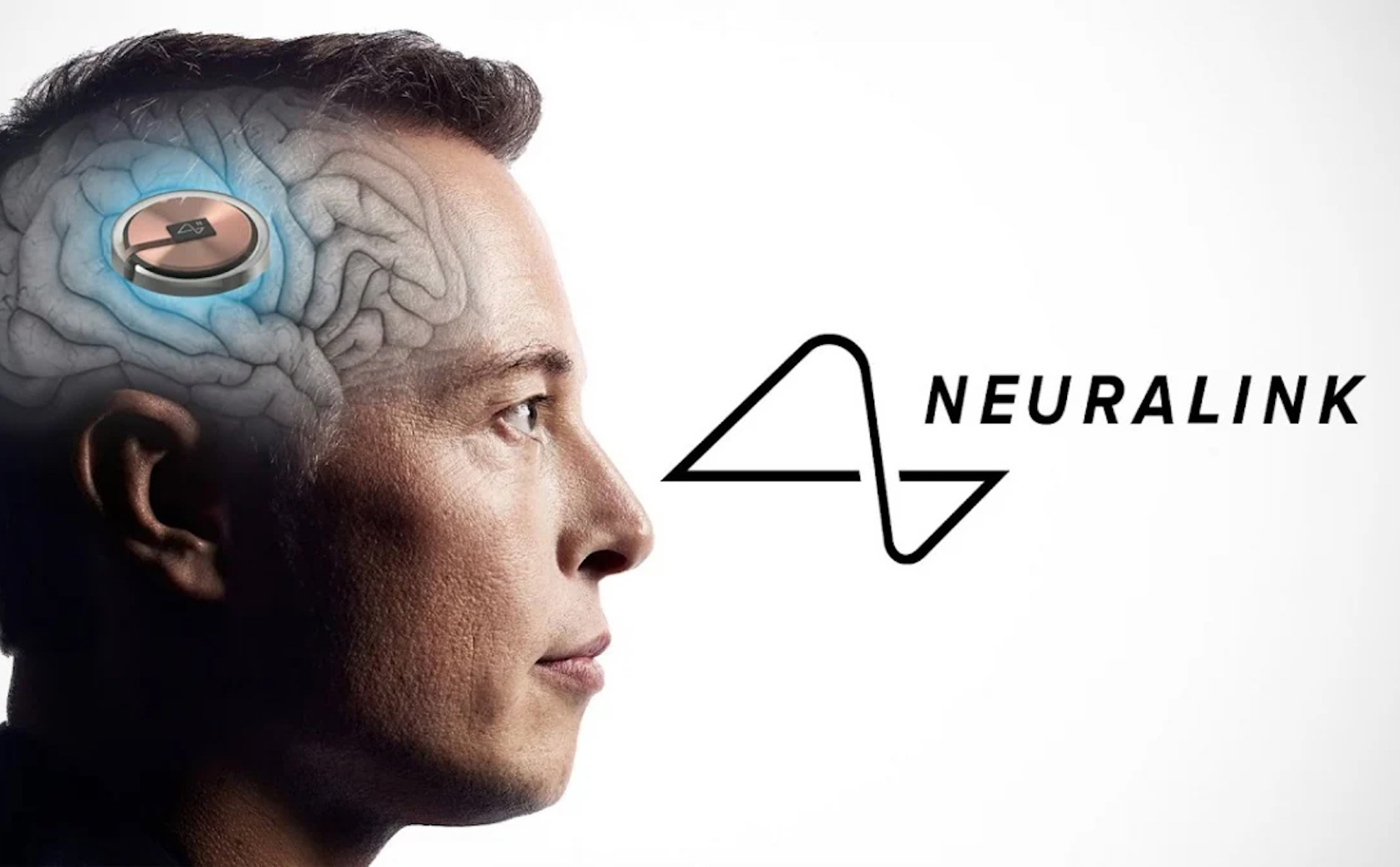 Neuralink tìm kiếm người bệnh thứ hai trên thế giới tham gia thử nghiệm cấy ghép chip não.