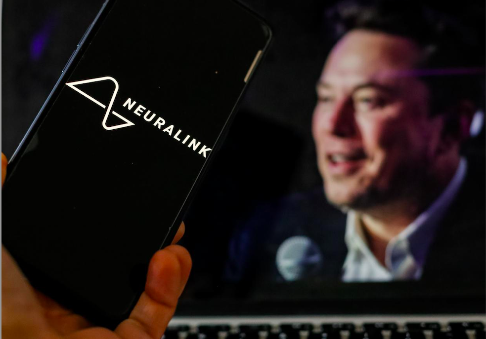 Neuralink từng cảnh báo rủi ro này trước khi Noland Arbaugh chấp nhận thực hiện phẫu thuật.