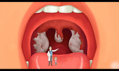 Bạch hầu từng là dịch bệnh ám ảnh của thế giới