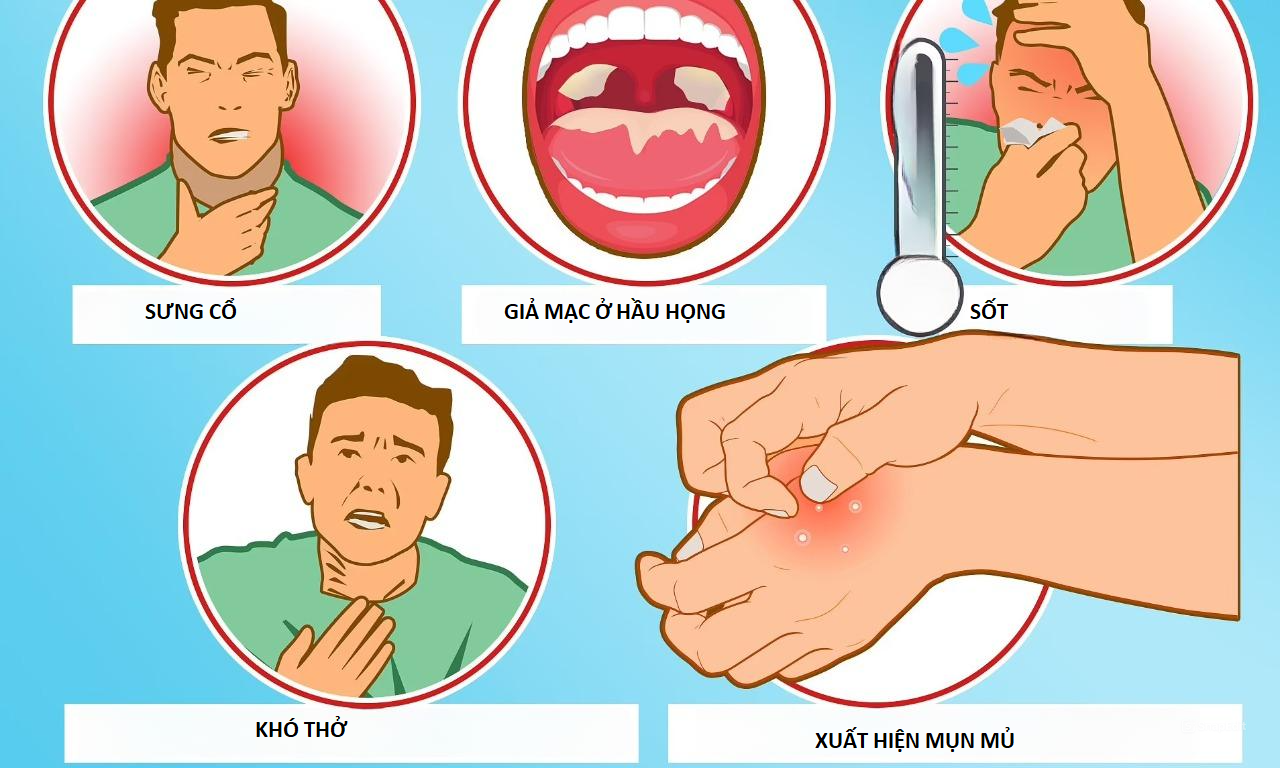 Khi thấy các triệu chứng điển hình, người bệnh nên nhanh chóng đến cơ sở y tế để thăm khám.