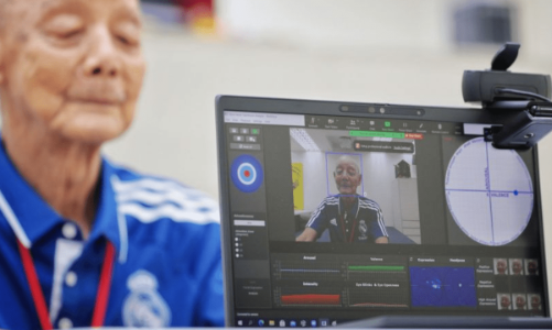 AI giúp theo dõi sức khỏe trong thời già hóa dân số