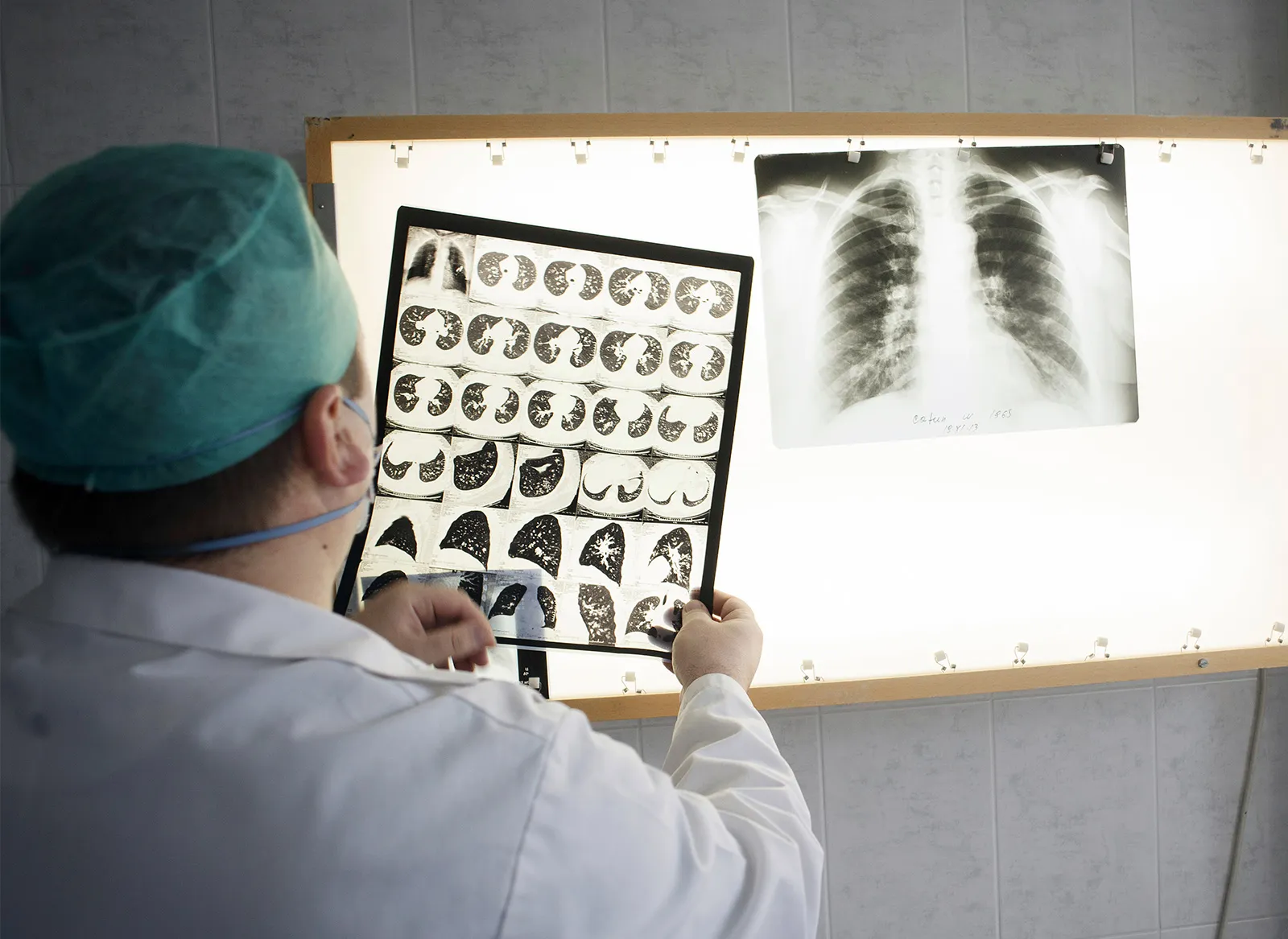 Việc ứng dụng AI trong việc tầm soát bệnh lao được chứng minh là hiệu quả trong việc rút ngắn thời gian chẩn đoán, tăng cường độ chính xác...