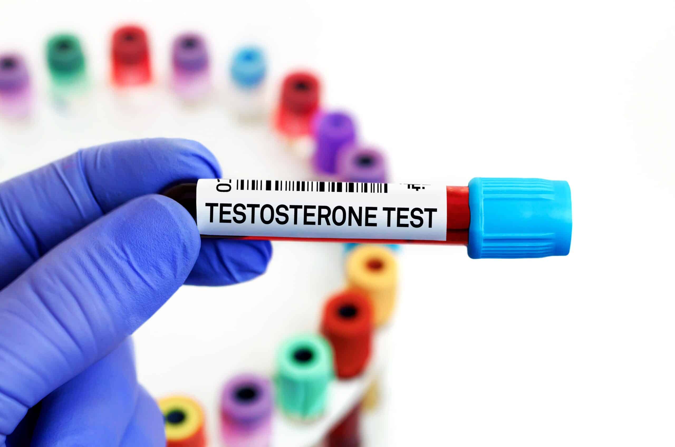 Có một mối liên quan chặt chẽ giữa việc suy giảm testosterone với các bệnh lý toàn thân.