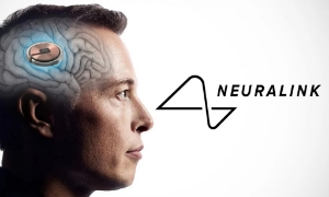 Neuralink tuyển dụng ồ ạt, chuẩn bị tiến tới sản xuất hàng loạt? 