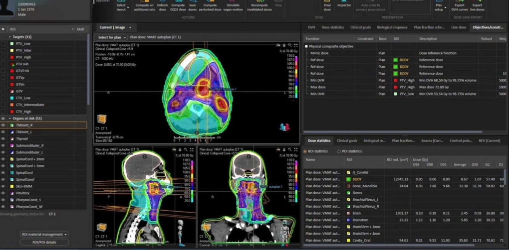 Bệnh viện Ung bướu TP HCM đ&atilde; ứng dụng tr&iacute; tuệ nh&acirc;n tạo (AI) để vạch kế hoạch xạ trị trong v&ograve;ng 2 - 5 ph&uacute;t thay v&igrave; 4 giờ như trước kia.