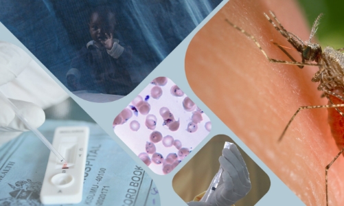 Bệnh lạ ở Congo một dạng sốt rét nặng