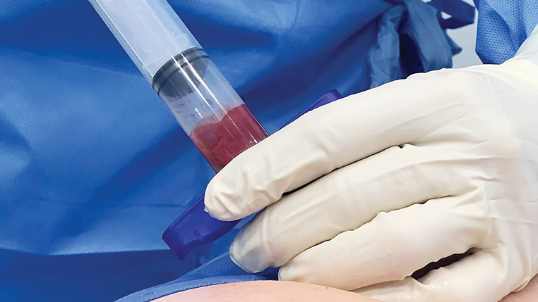 Việc ph&aacute;t triển th&agrave;nh c&ocirc;ng c&ocirc;ng nghệ tạo tế b&agrave;o gốc đang mở ra hướng đi mới cho c&aacute;c startup to&agrave;n cầu.