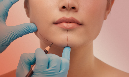 Làm đẹp cấp tốc đón Tết: Nhắc lại không thừa