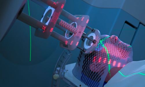 Xạ trị proton là gì mà sẽ được bảo hiểm y tế chi trả?