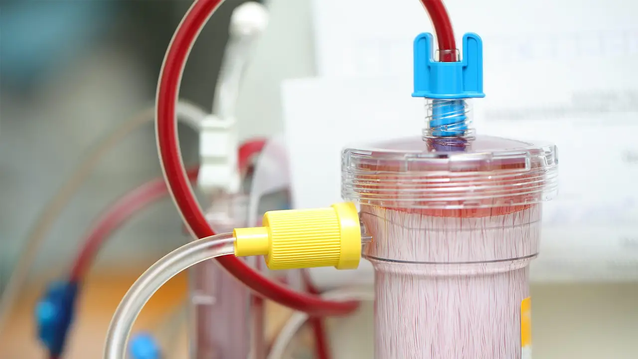 Việc tự ý lọc máu có thể loại bỏ cả cholesterol có lợi, làm tổn hại đến sức khỏe của mạch máu và tim mạch.