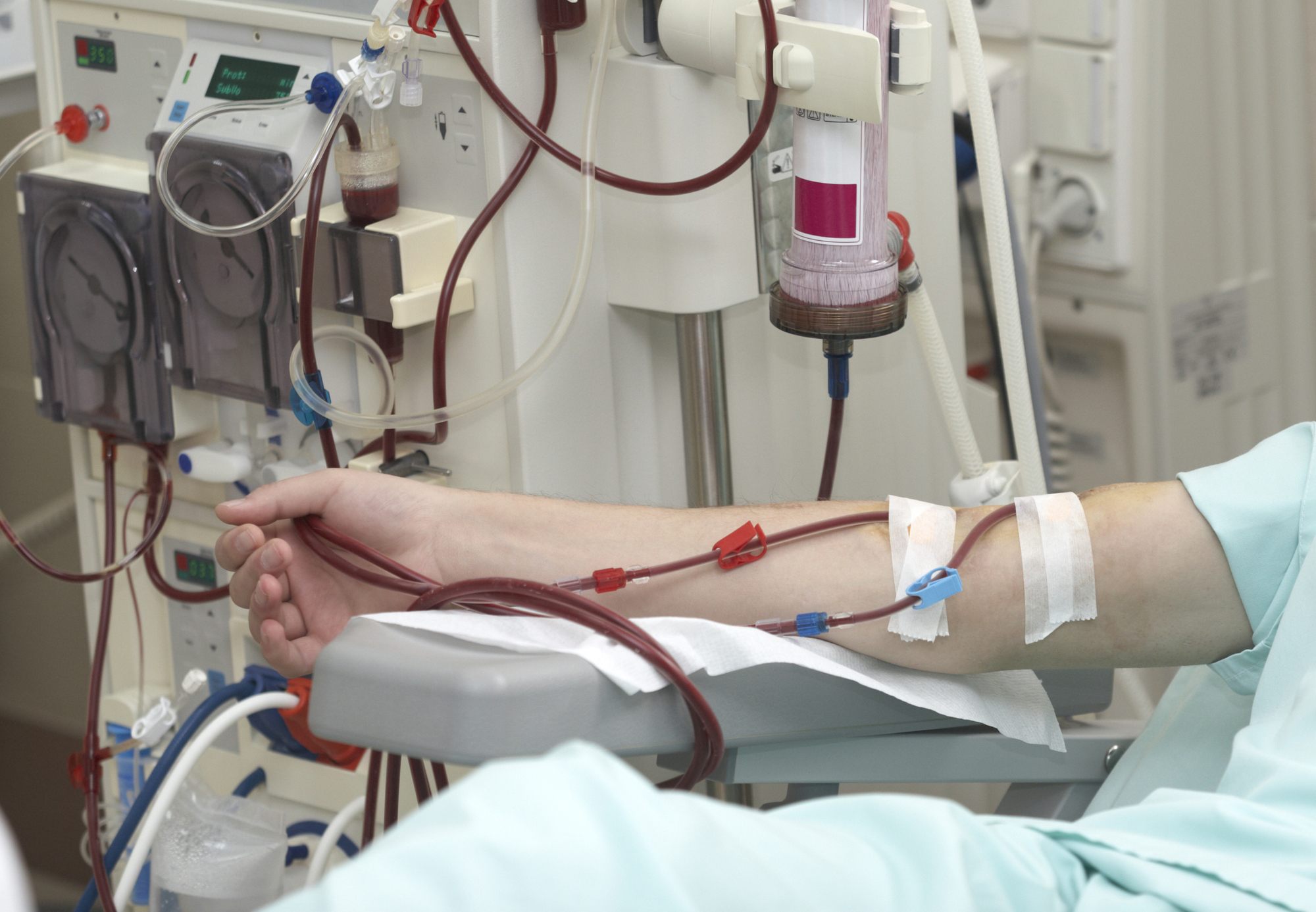 Việc tự ý thực hiện lọc máu khi không có chỉ định y khoa có thể khiến người dân rơi vào tình trạng “tiền mất, tật mang”.