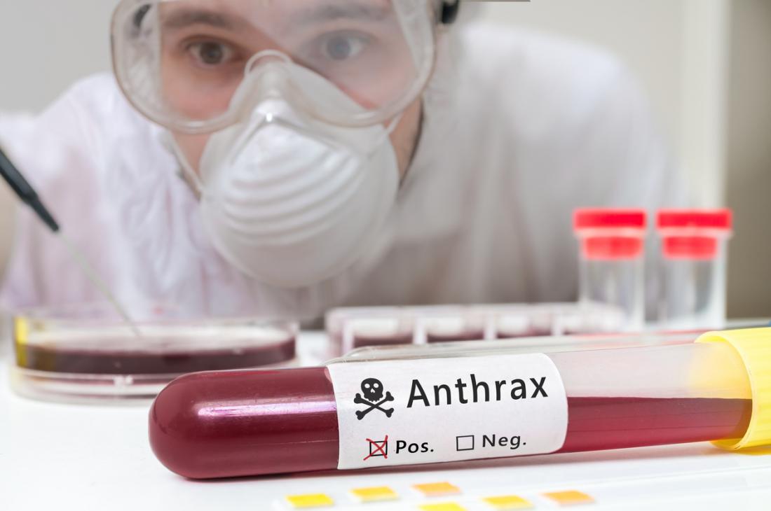 Ảnh: Medical News Today