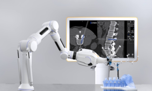 Ứng dụng Robot trong điều trị bệnh lý cột sống