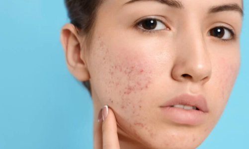 Mỹ phẩm hay thực phẩm chức năng giả đều gây hại cho sức khỏe