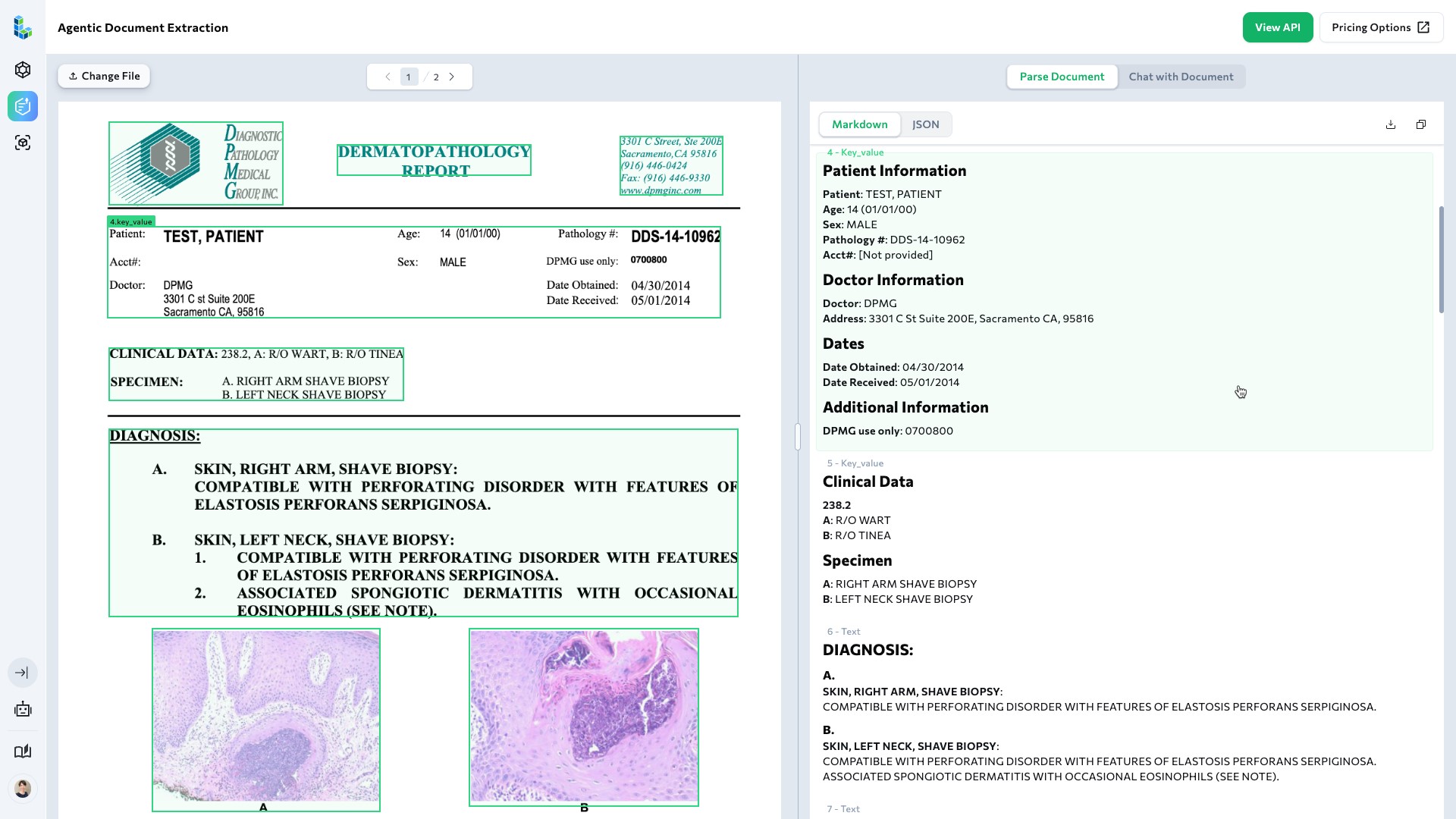 Nền tảng ứng dụng Agentic AI c&oacute; khả năng tr&iacute;ch xuất v&agrave; xử l&yacute; dữ liệu h&igrave;nh ảnh vượt trội so với c&ocirc;ng nghệ truyền thống. Nguồn: LandingAI.