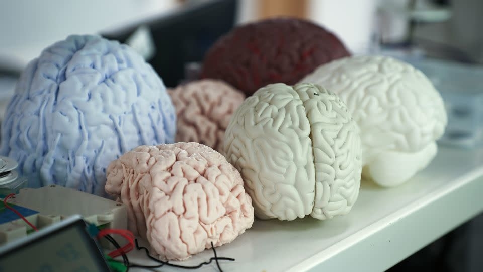 M&ocirc; h&igrave;nh n&atilde;o bộ được trưng b&agrave;y b&ecirc;n trong ph&ograve;ng th&iacute; nghiệm CIBR tại Bắc Kinh, Trung Quốc.