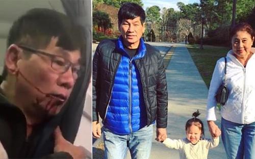 Bác sỹ David Dao sau khi bị hành hung trên máy bay (ảnh trái) và khi cùng vợ và cháu gái (ảnh phải).<br>