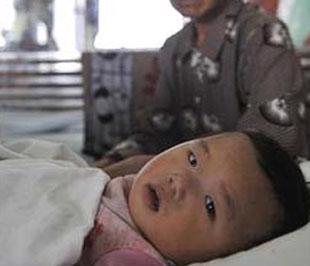 Một em bé Trung Quốc bị nhiễm độc do dùng sữa bột có chứa chất melamine đang được điều trị trong bệnh viện.