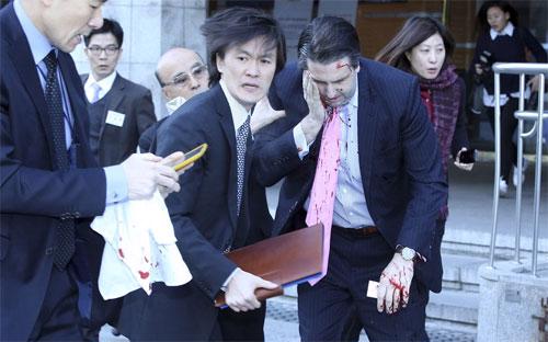 Đại sứ Mỹ tại Hàn Quốc Mark Lippert được đưa tới bệnh viện sau khi bị kẻ tấn công dùng dao lam rạch mặt sáng nay (5/3) tại Seoul - Ảnh: Reuters.<br>