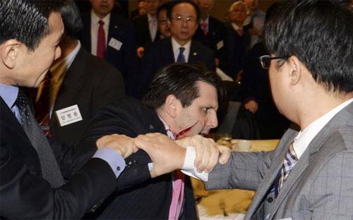 Đại sứ Mỹ tại Hàn Quốc Mark Lippert sau khi bị một kẻ tấn công rạch mặt ở Seoul hôm 5/3 - Ảnh: Reuters.<br>