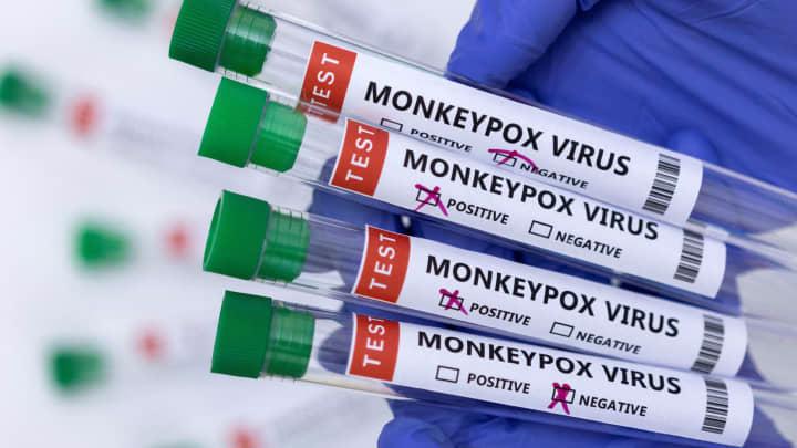 Các ống xét nghiệm có nhãn âm tính và dương tính với virus đậu mùa khỉ - Ảnh: Reuters