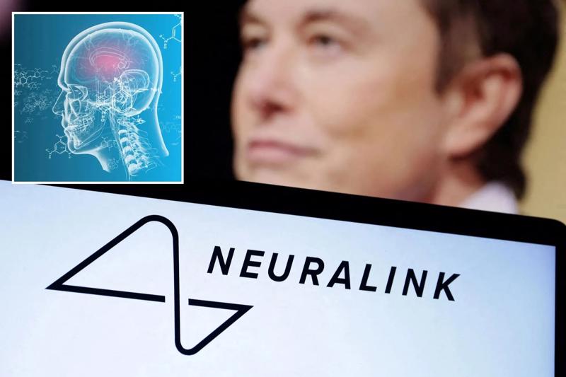 Công ty cấy ghép não của Elon Musk Neuralink bắt đầu thử nghiệm trên người