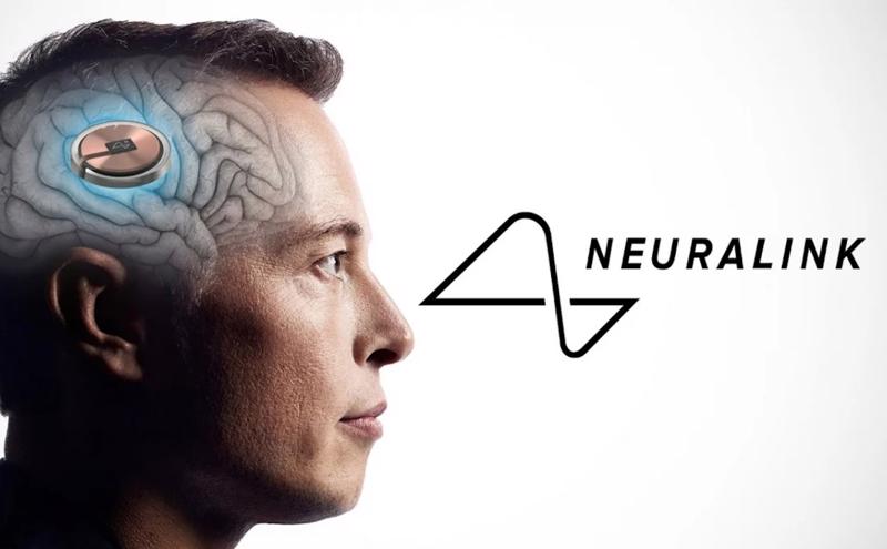 Neuralink tuyển dụng ồ ạt, chuẩn bị tiến tới sản xuất hàng loạt? 